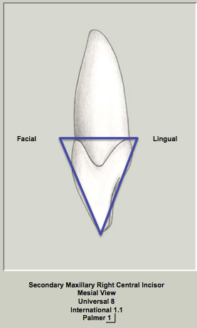 Mx Central Proximal Triangular.png